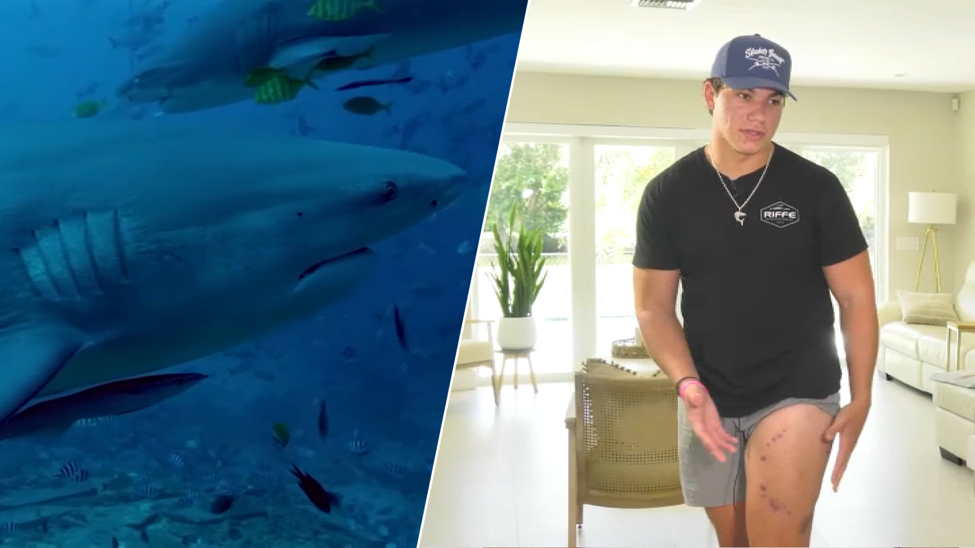 Man makes incredible recovery after suffering shark bite in