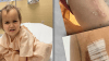 Are contaminated needles to blame? Over 50 kids ended up infected after routine doctor's visit 