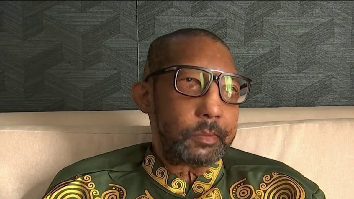 The First African American Man To Receive A Full Face Transplant Is Thrilled With The Results