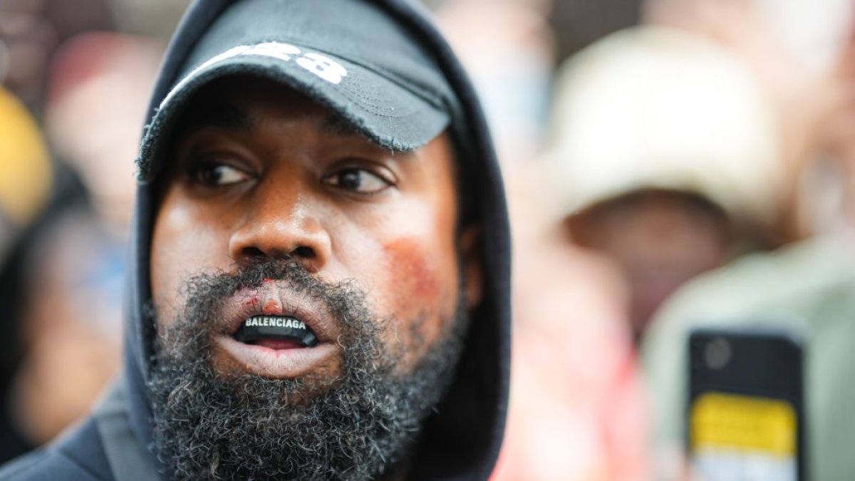 Kanye West&#039s ‘titanium teeth&#039 are long-lasting, rep suggests