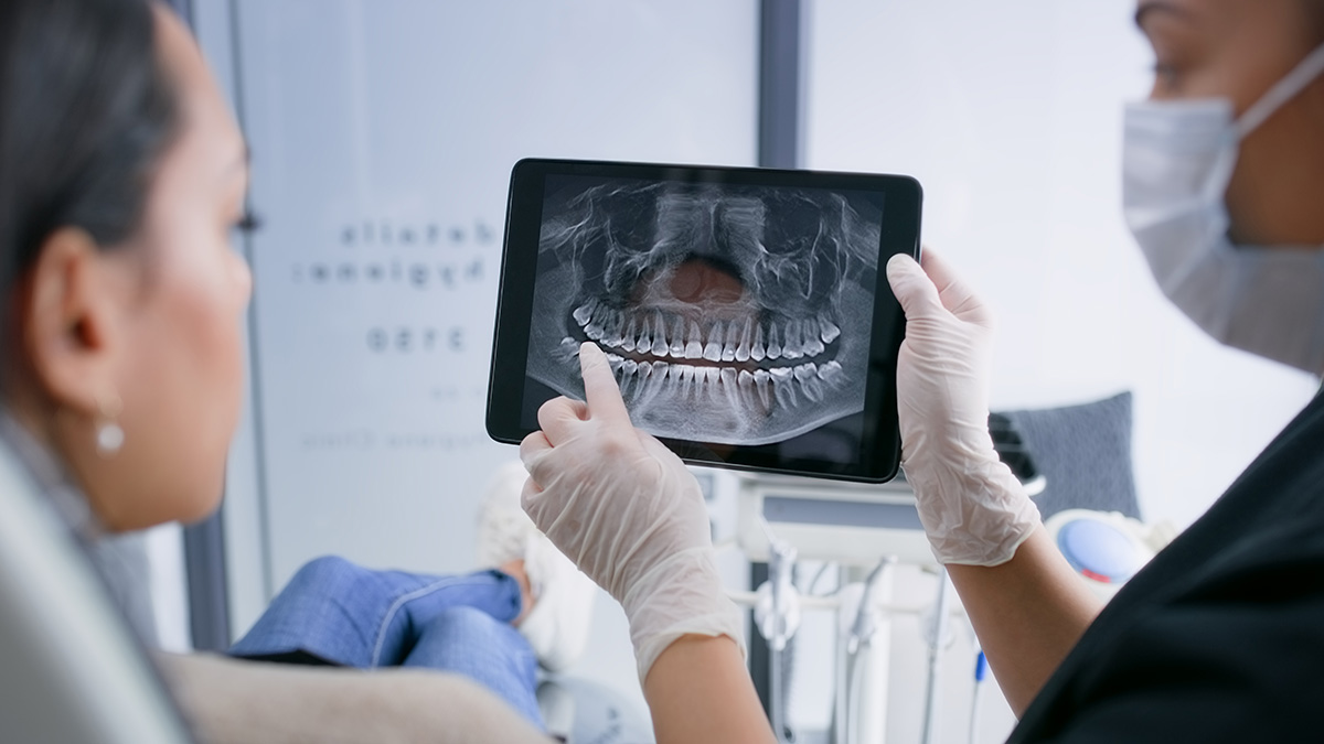 The facts behind community fluoridation, which can reduce tooth decay by 25% The facts behind community fluoridation, which can reduce tooth decay by 25%