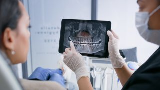 Hands, tablet and teeth xray, dentist and patient with dental surgery and health, people and orthodontics at clinic. Healthcare, wellness and digital scan of mouth on screen with cavity or gingivitis