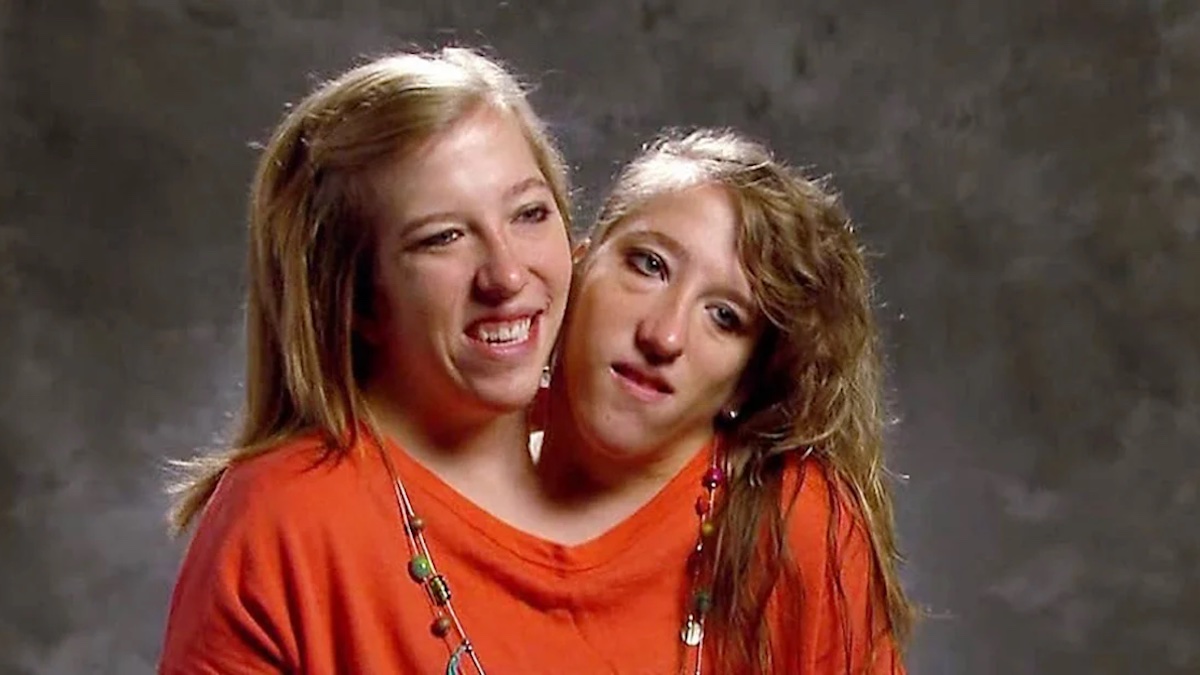 Conjoined twin Abby Hensel is now married