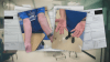 Janitorial workers at local university blame cleaning product for allergic reactions