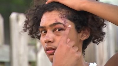 Student speaks out after being brutally attacked near SLAM! Charter School