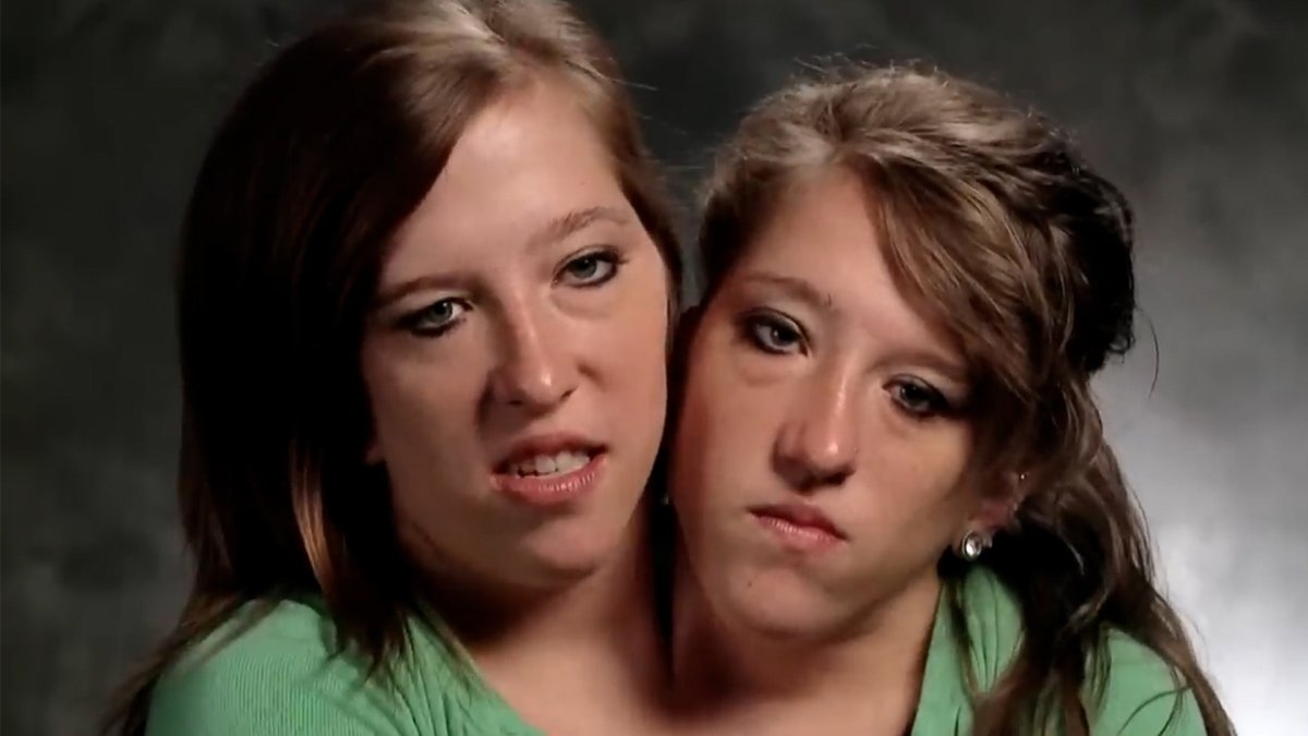 Conjoined twins Abby and Brittany Hensel epically clap back again at haters