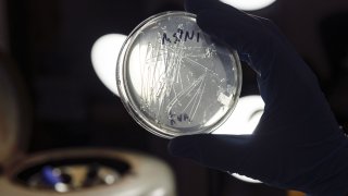 File - A petri dish with bacteria is held to a light at The Odin biohacking supply company in 2020.