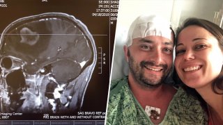 A brain scan in April 2019 shows a tumor growing near John Shadock’s skull. He credits his wife, Ali, for helping him thrive five years later.