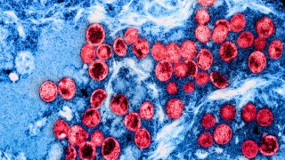 Colorized transmission electron micrograph of monkeypox virus particles (red) found within an infected cell (blue), cultured in the laboratory.