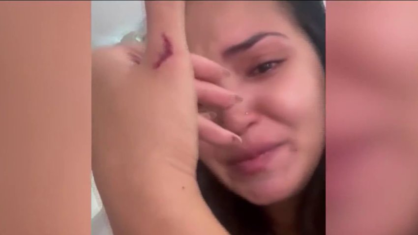 TikTok influencer shot at and nearly killed by ex-stepdad: Police