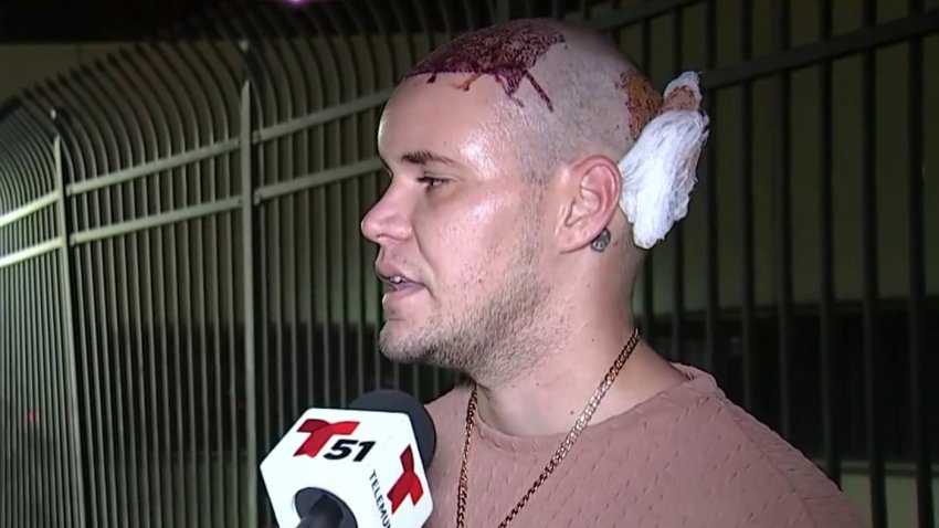 A man who was bleeding from his head after a hair transplant was arrested along with his wife after they refused to get off of a flight in Miami.  