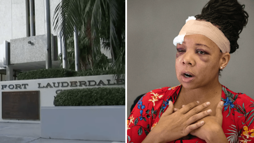 A judge ruled Wednesday that Fort Lauderdale officers cannot be held liable after a woman was shot in the face by a rubber bullet during protests over George Floyd’s murder. Still, attorneys for LaToya Ratlieff celebrate a victory.