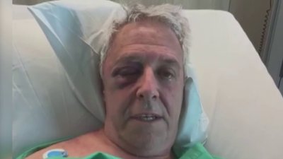 South Florida doctor recalls moment he was attacked by patient's son