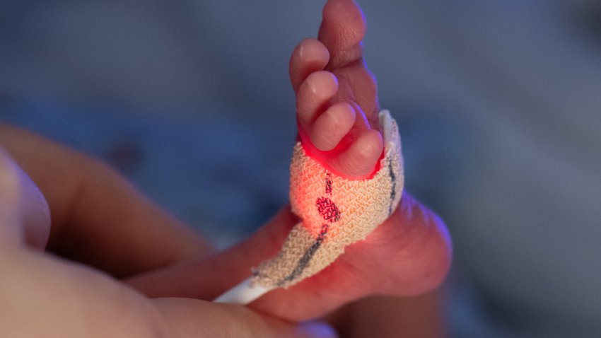 Premature babies are accompanied into life