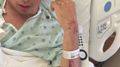 Hit-and-run victim calls for suspect to come forward