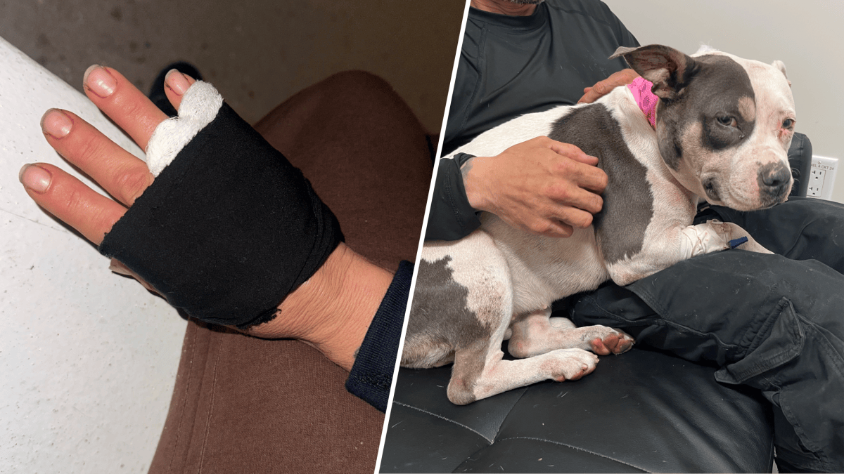 Dog fight leads to gunfire in Fort Lauderdale, woman speaks out – NBC 6 ...