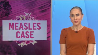 Measles case confirmed in Broward County involving young child