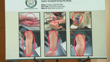 Broward Sheriff Gregory Tony said Sgt. Zakiyyah Polk was injured in a 2022 encounter with a jail inmate.