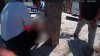 Bodycam footage shows crews helping 9-year-old bitten by shark in Florida