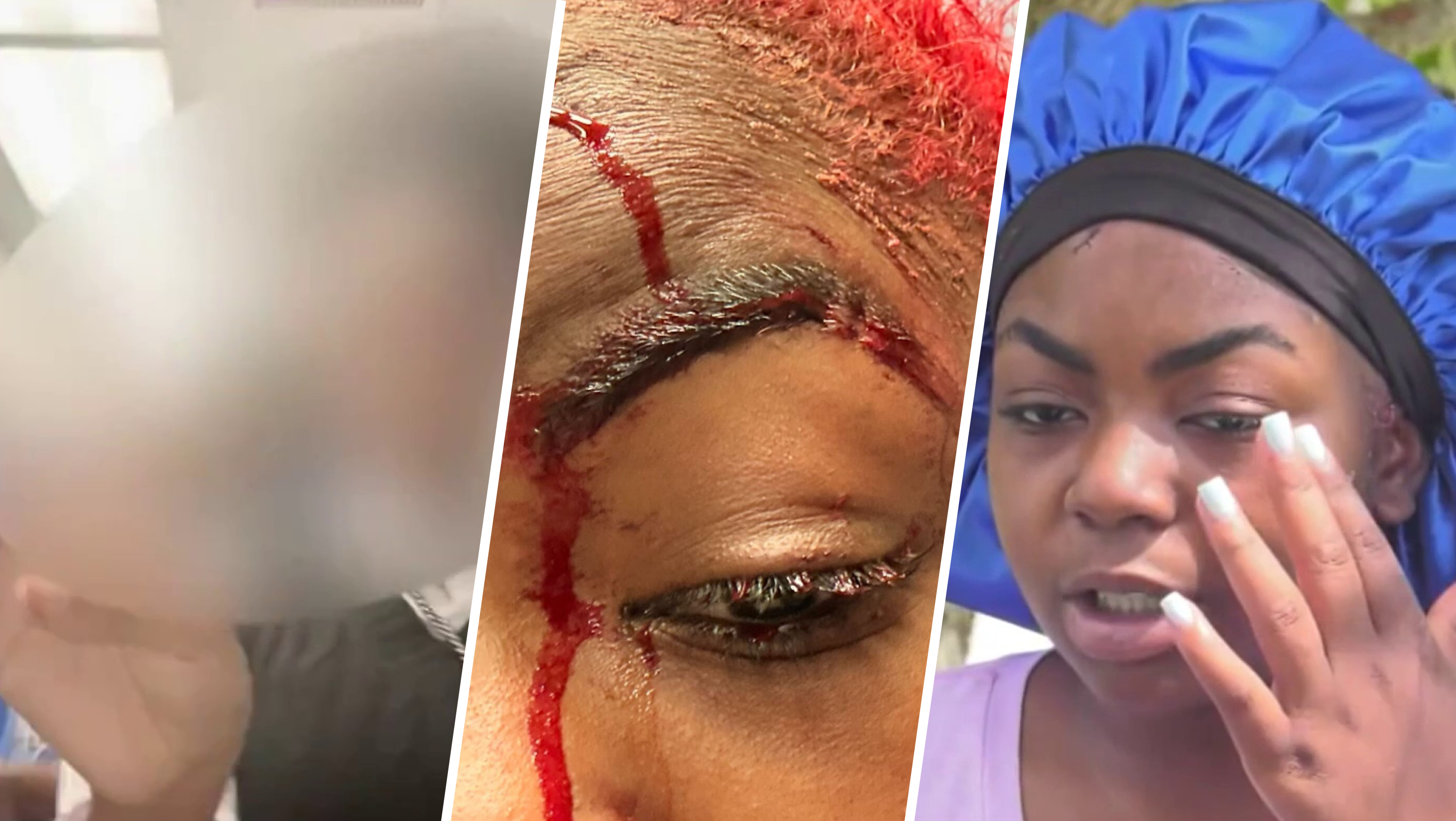 ‘Blood everywhere': 17-year-old speaks out after she was beaten in Miami Northwestern bathroom