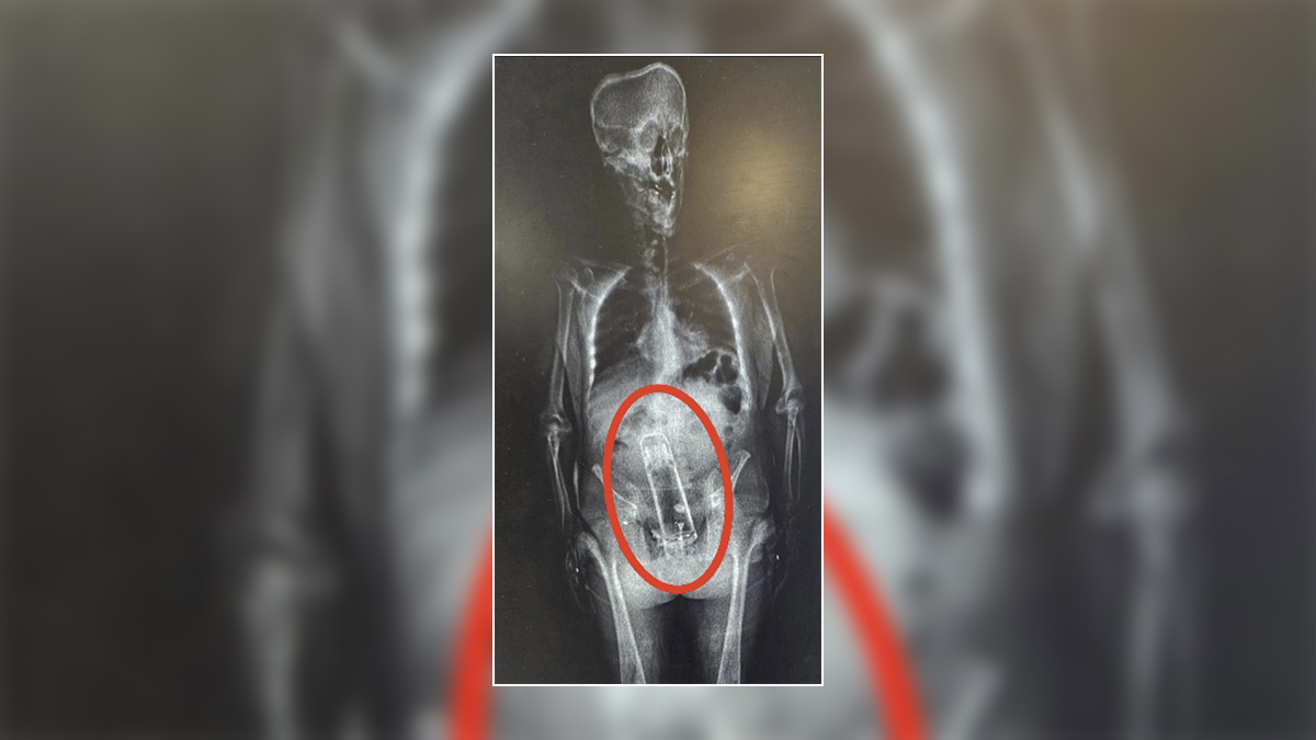 NextImg:‘He put it up the exit ramp': Florida sheriff says man had thermos hidden in body