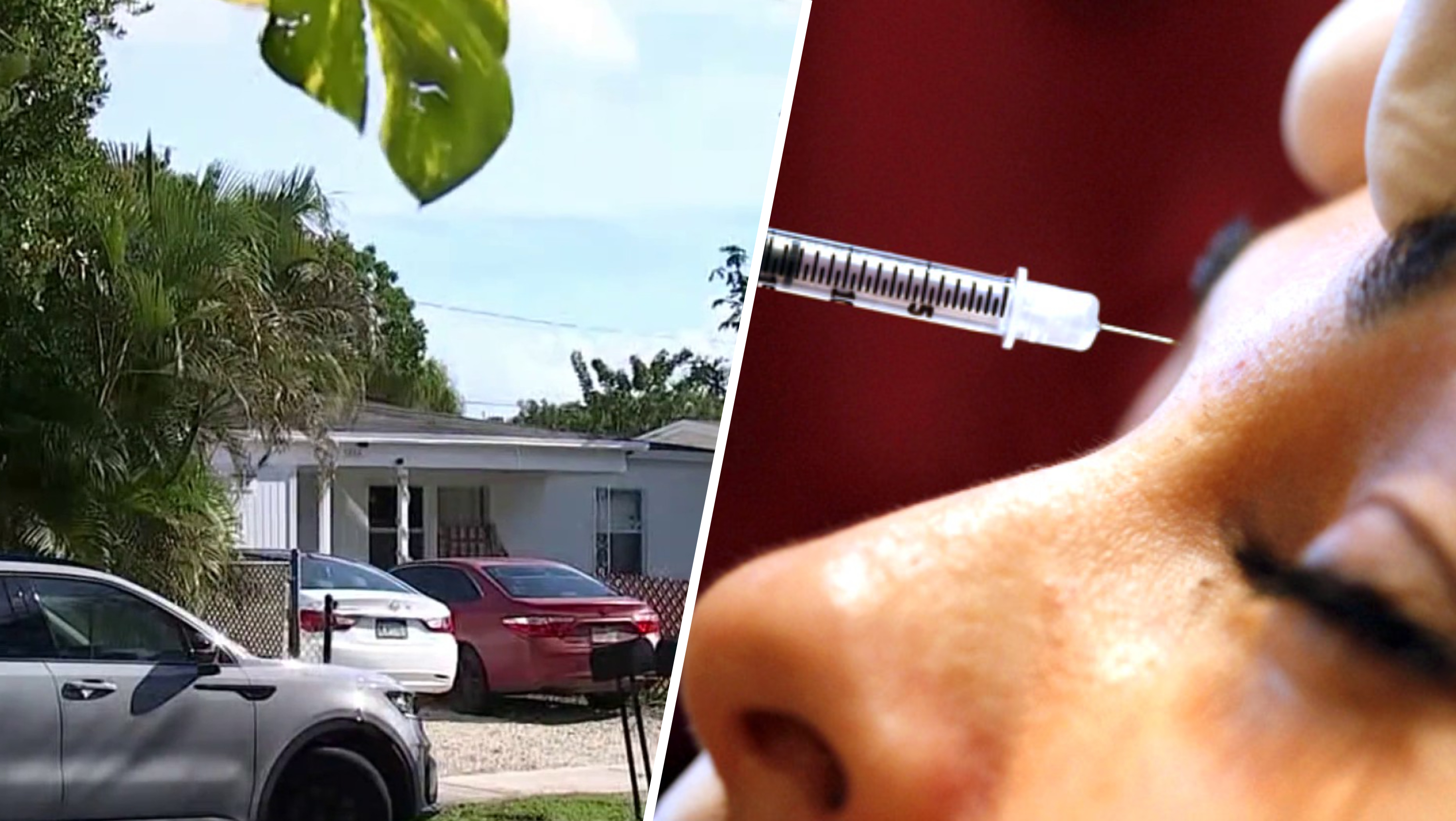 Woman accused of administering Botox from Oakland Park home without license: Police