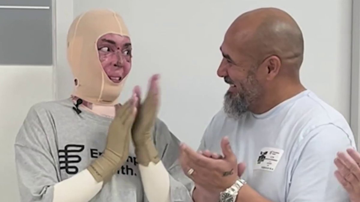 Florida woman who suffered traumatic burns after accident is heading home