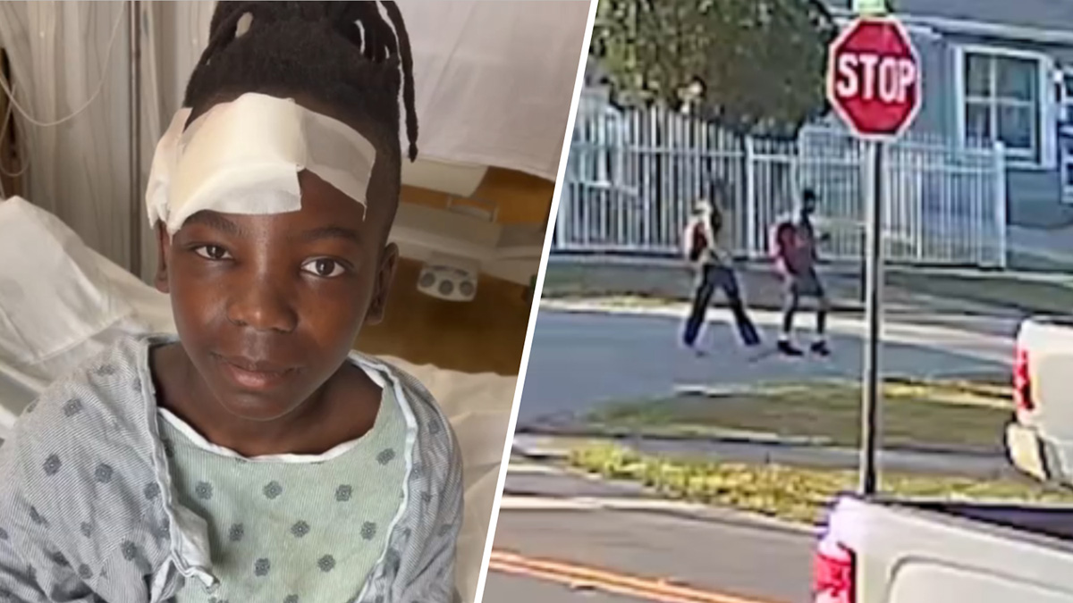 Boy hit by car in Miami Gardens continues recovery as driver faces charges