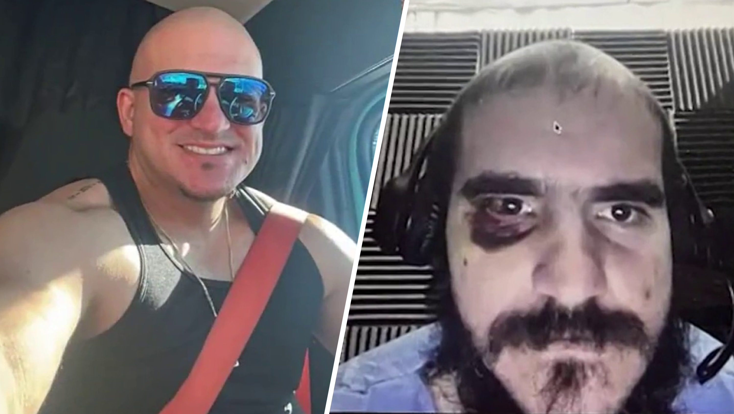 Detainees detail beatings and abuse at ‘Alligator Alcatraz'