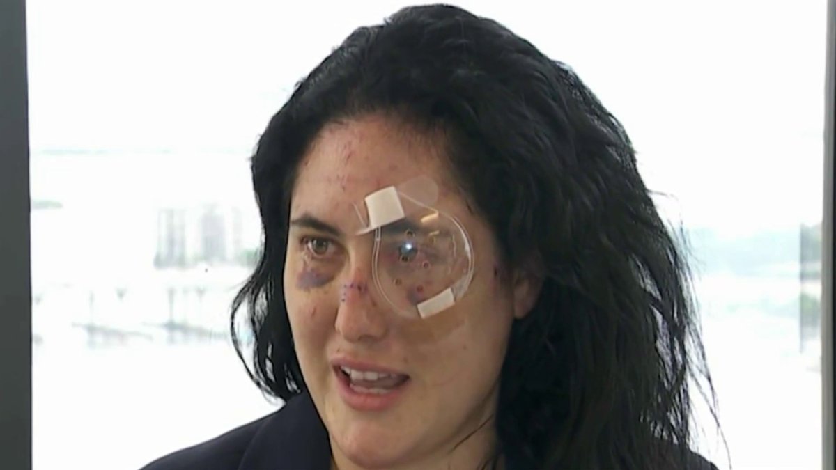 Downtown Miami stabbing victim says she was prepared to die – NBC 6 South  Florida